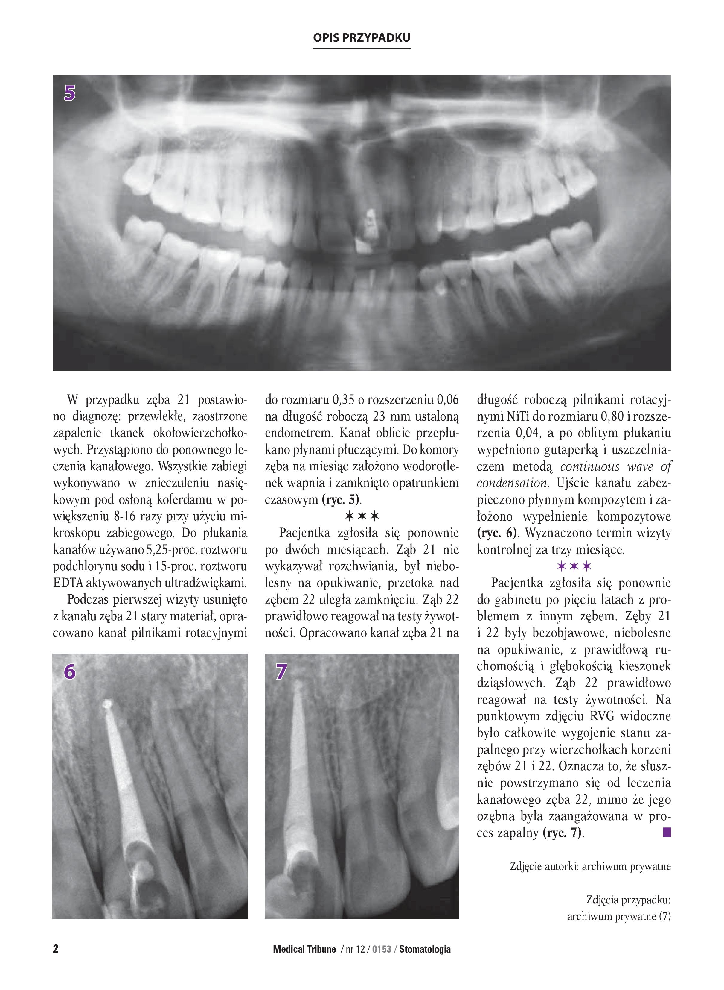 Publikacja w Medical Tribune Stomatologia nr 12/2015